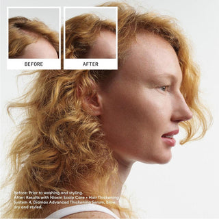 Nioxin Density System 4 Scalp Therapy Conditioner (Colored Hair, Progressed Thinning, Color Safe) 1000ml/33.8oz