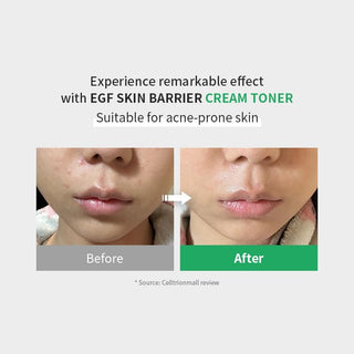 Z+PIDERM ECF Skin Barrier Cream Toner