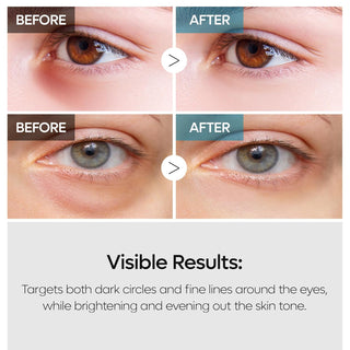 Dr. Melaxin TX Retinalsome Double Effect Eye Cream
