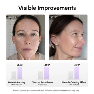 12% Niacinamide Smooth & Glow Pads