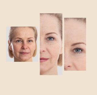 The Eraser Spot Cream | Dark Spot Corrector